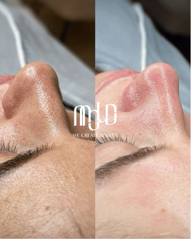 Why OFWs Choose Mold Manila for Safe, Time‑Efficient Aesthetic Care During Philippine Visits